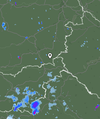 Radar