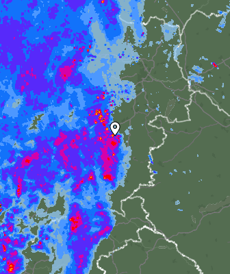 Radar
