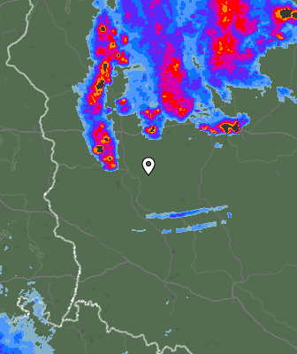 Radar