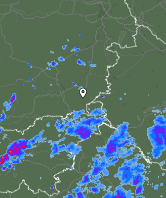 Radar