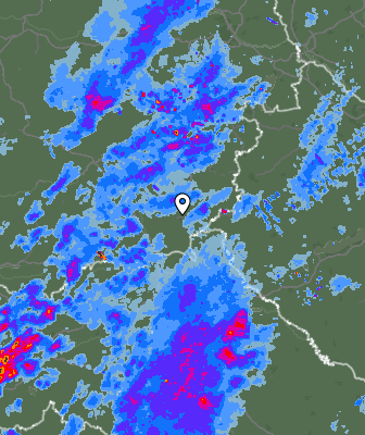 Radar