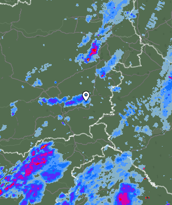 Radar