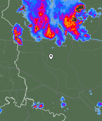 Radar