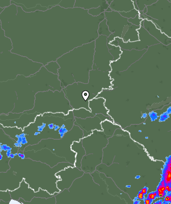 Radar