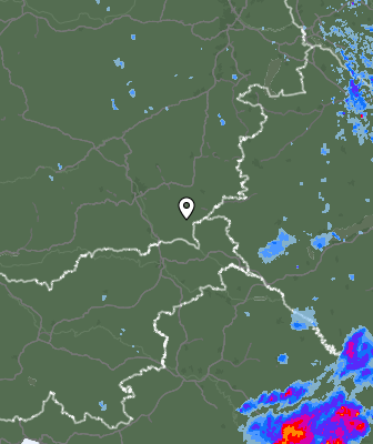 Radar