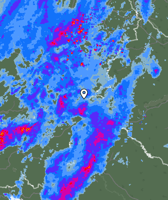 Radar