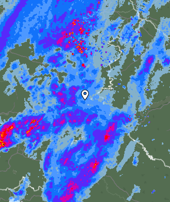 Radar