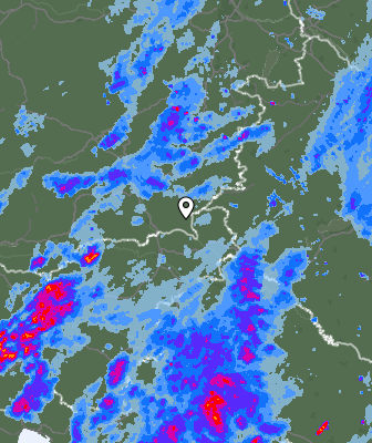 Radar