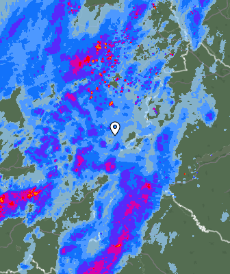 Radar