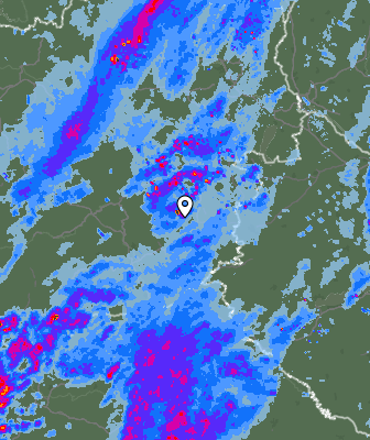 Radar