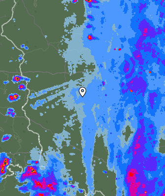 Radar