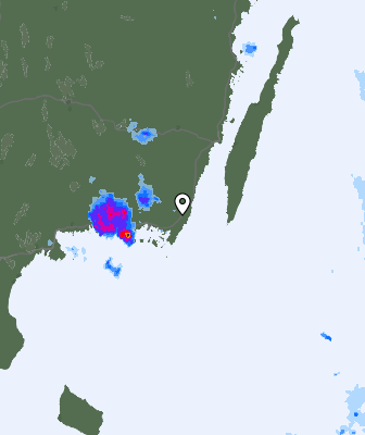 Radar