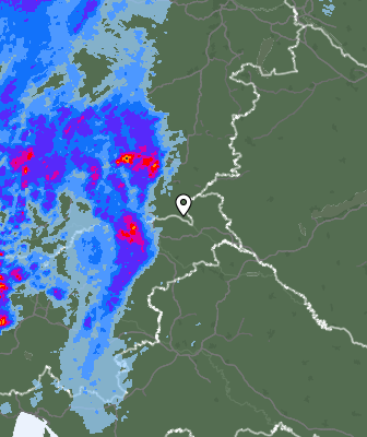 Radar