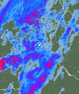 Radar
