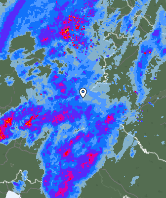 Radar