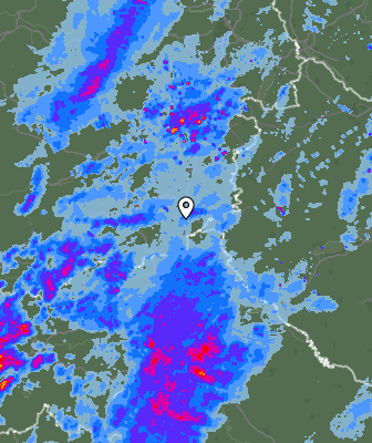 Radar
