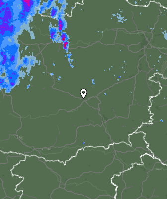 Radar