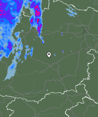 Radar
