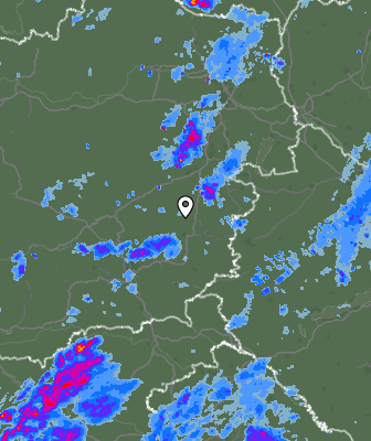 Radar