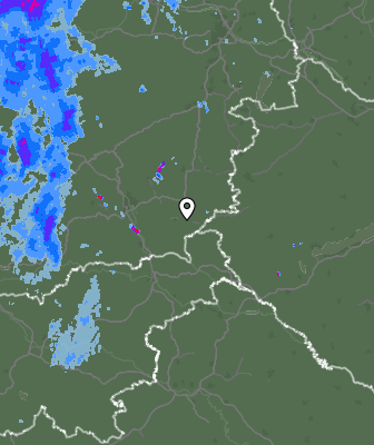 Radar