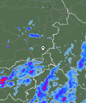 Radar