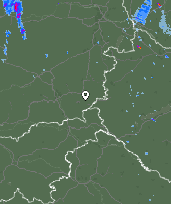 Radar