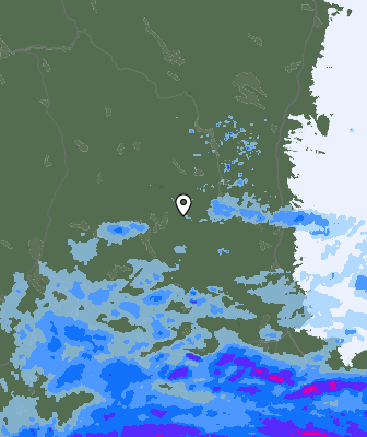Radar