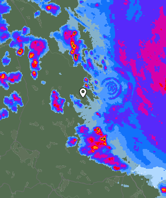 Radar