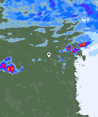 Radar