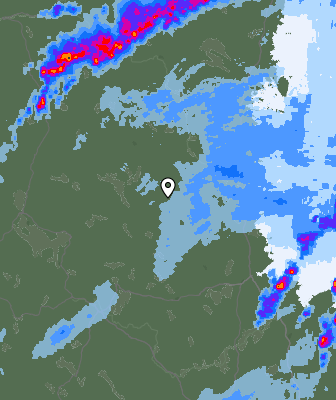 Radar