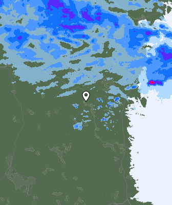 Radar
