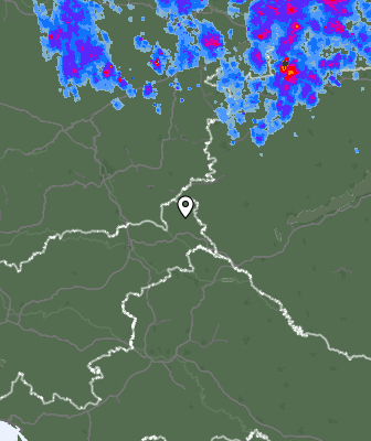Radar