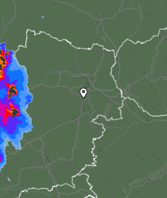 Radar