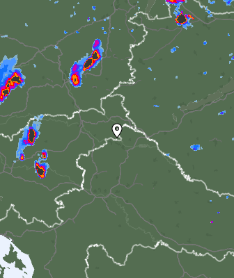 Radar