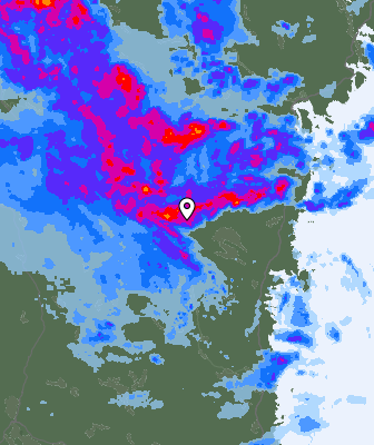 Radar
