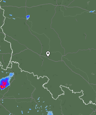 Radar