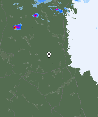 Radar