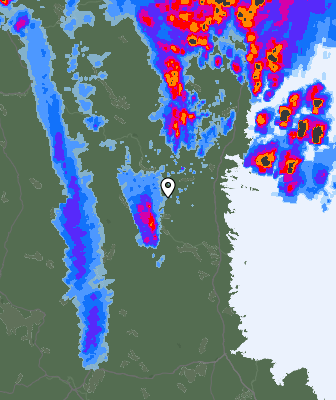 Radar