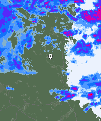 Radar