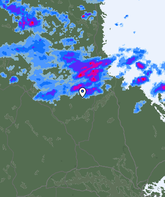 Radar