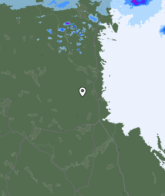 Radar