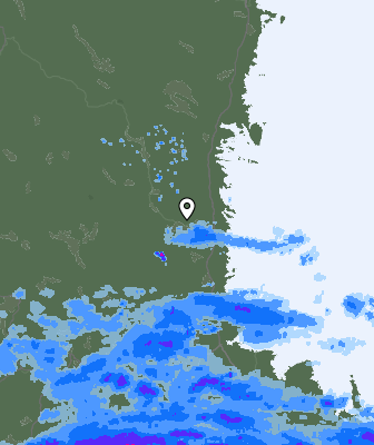 Radar