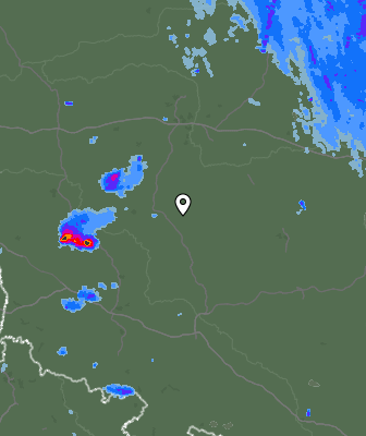 Radar