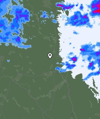 Radar