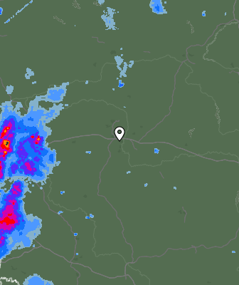 Radar