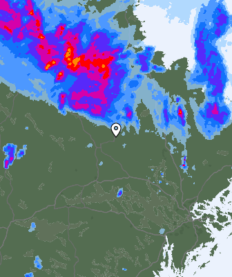 Radar