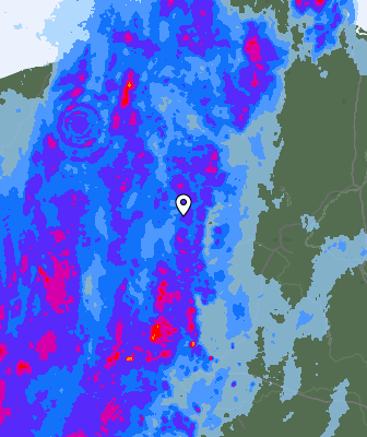 Radar