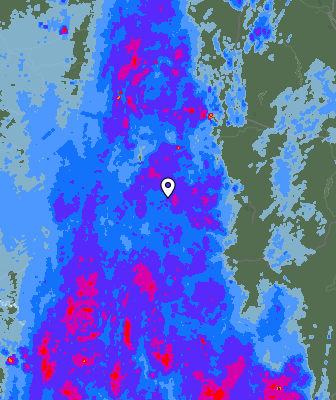 Radar