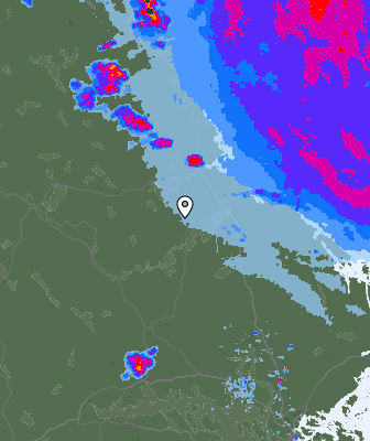 Radar