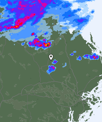 Radar